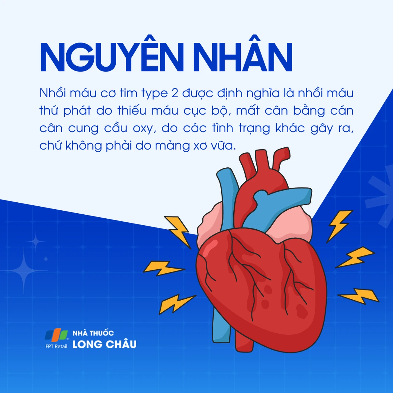 Nhồi máu cơ tim type 2 3