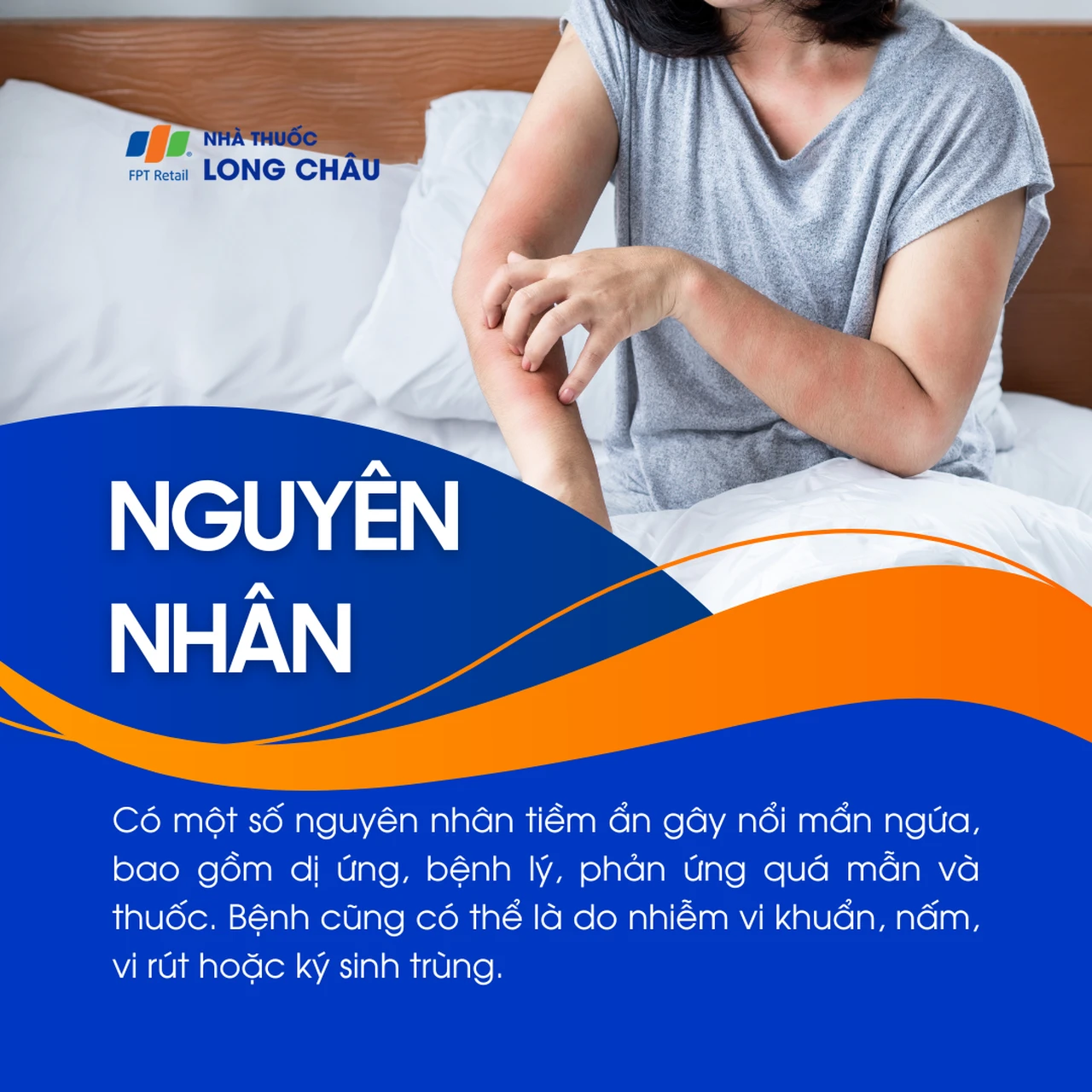 Nổi mẩn ngứa 3