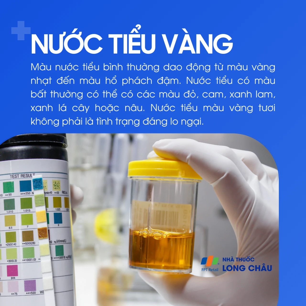 Nước tiểu vàng 1