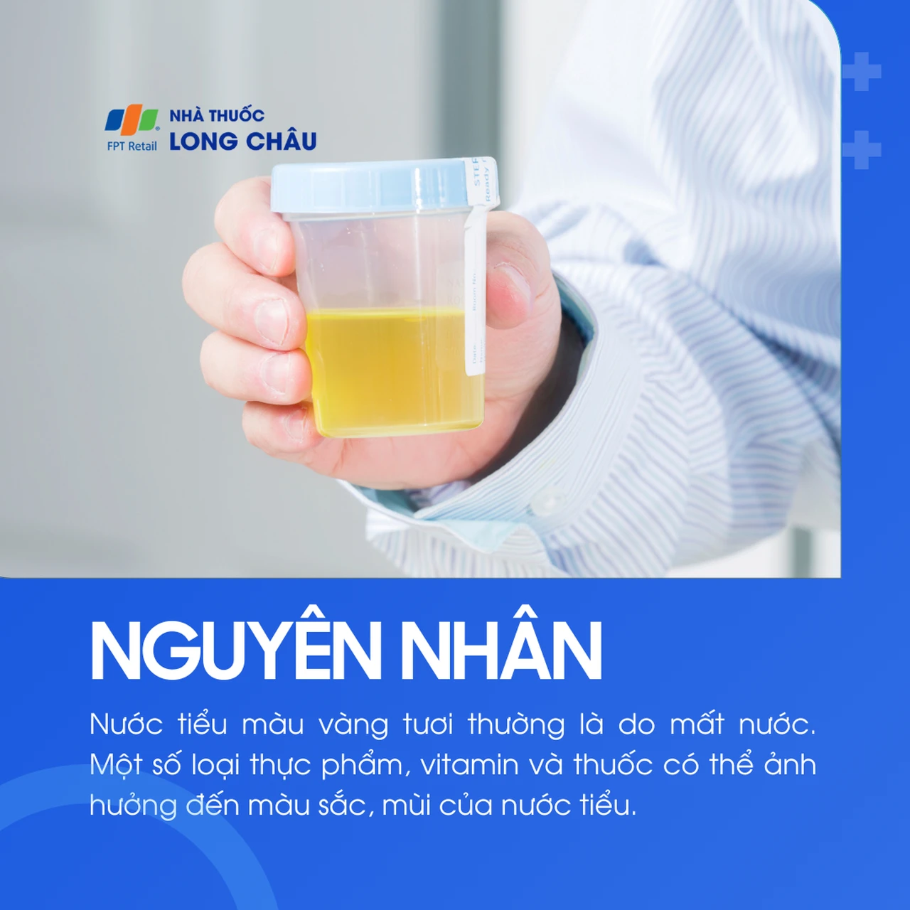Nước tiểu vàng 3