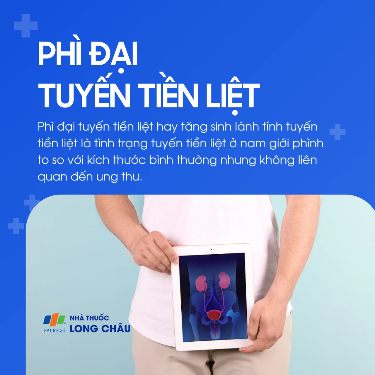 Phì đại tuyến tiền liệt 1