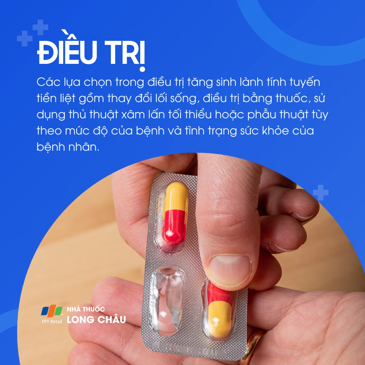 Phì đại tuyến tiền liệt 6