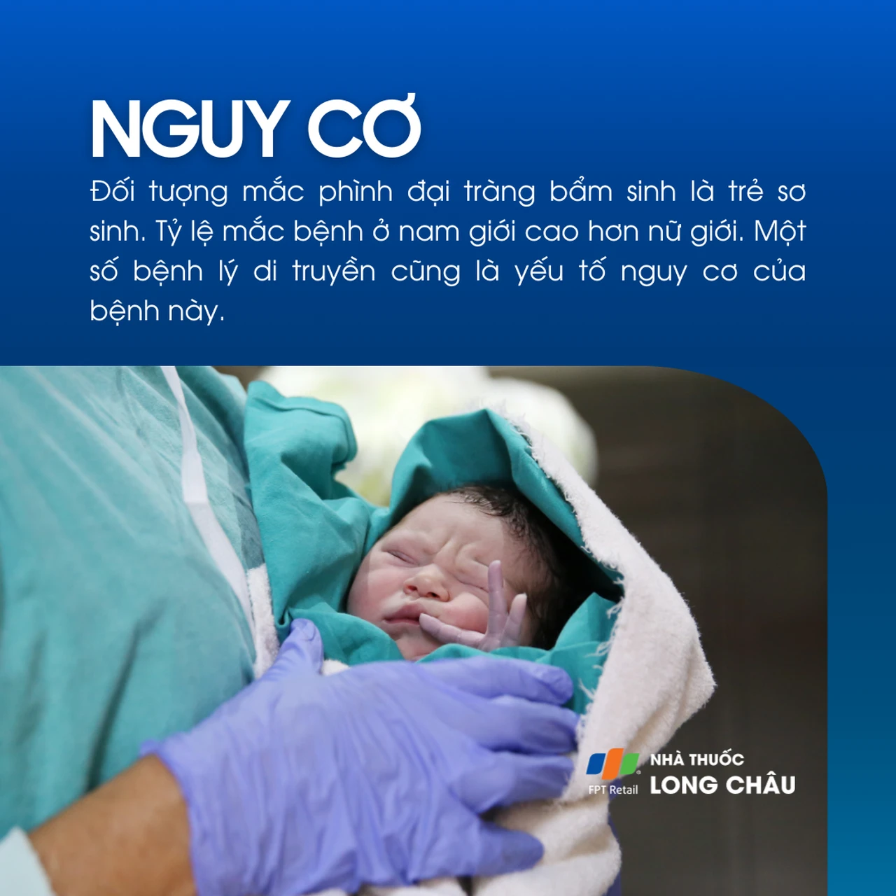 Phình đại tràng bẩm sinh 4