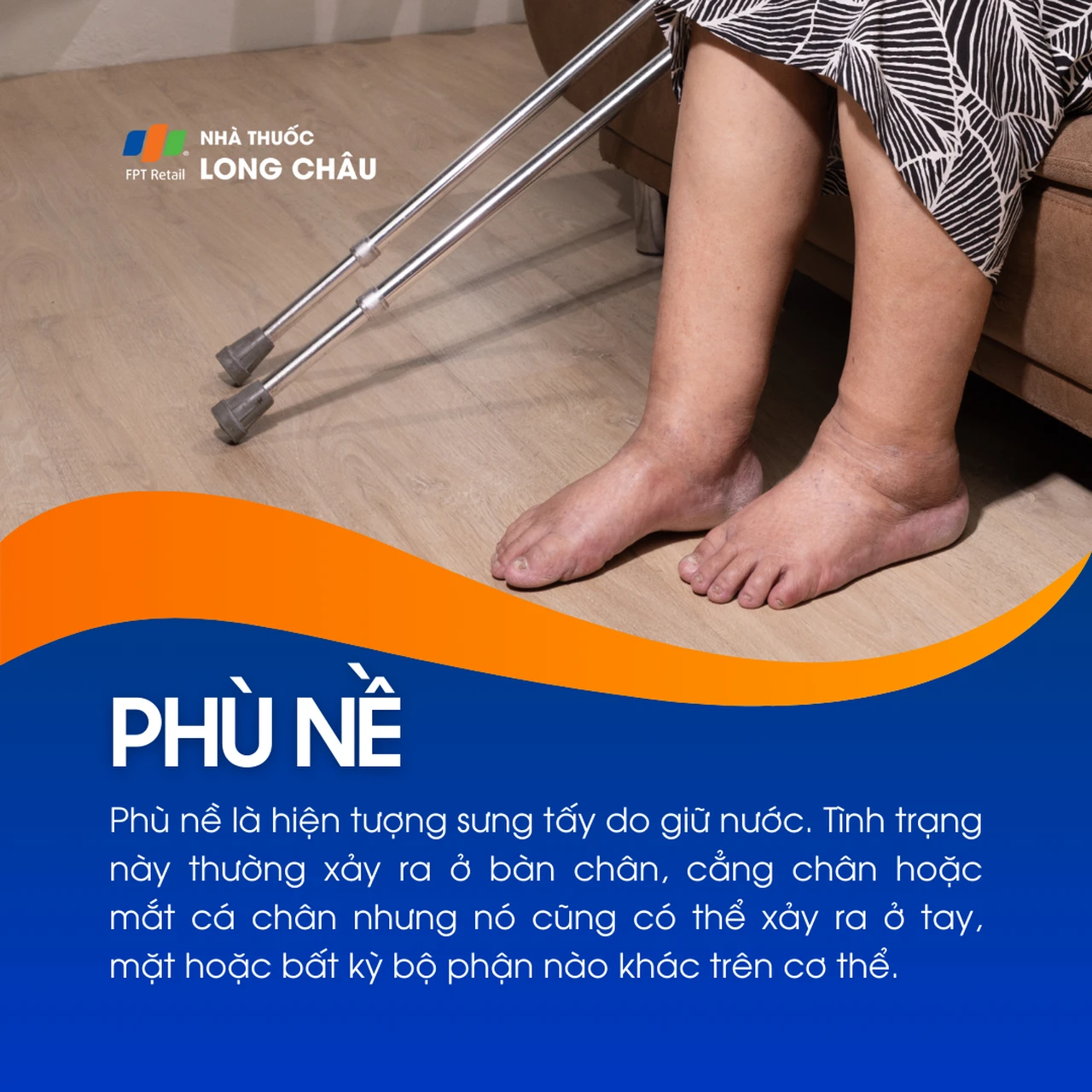 Phù nề 1