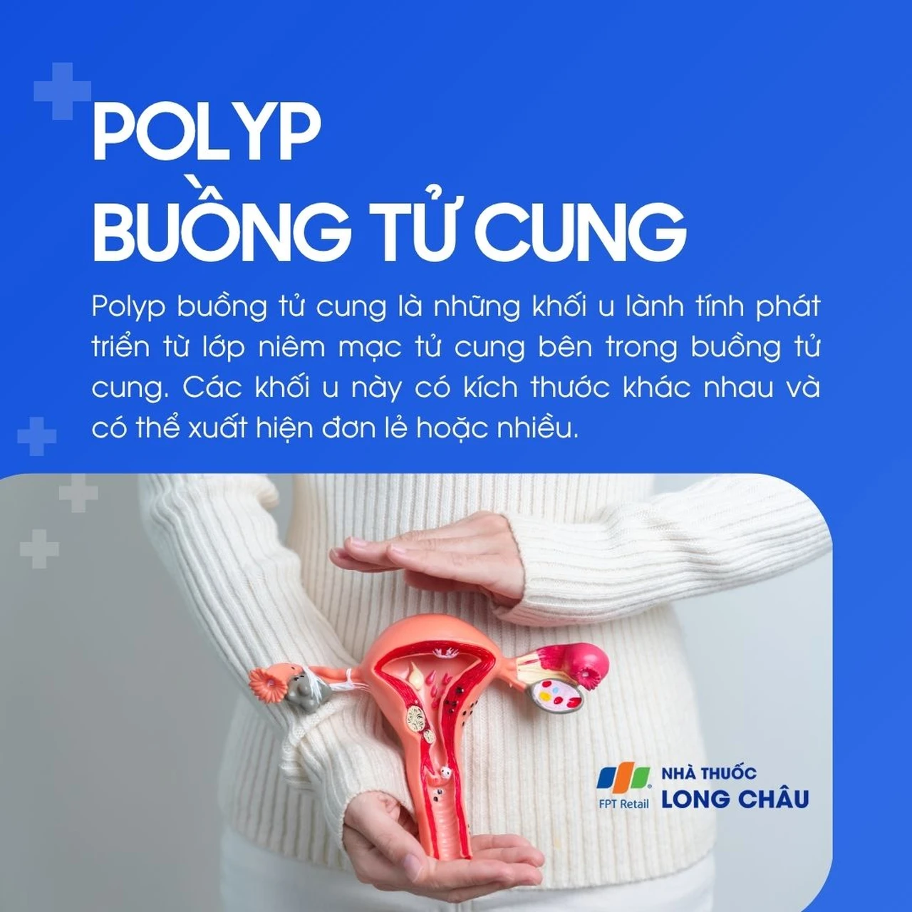 Polyp buồng tử cung 1