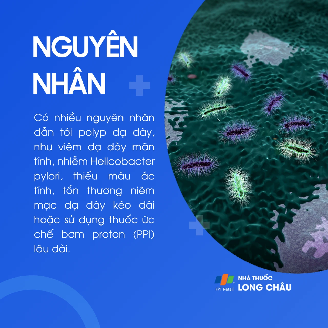Polyp dạ dày 3