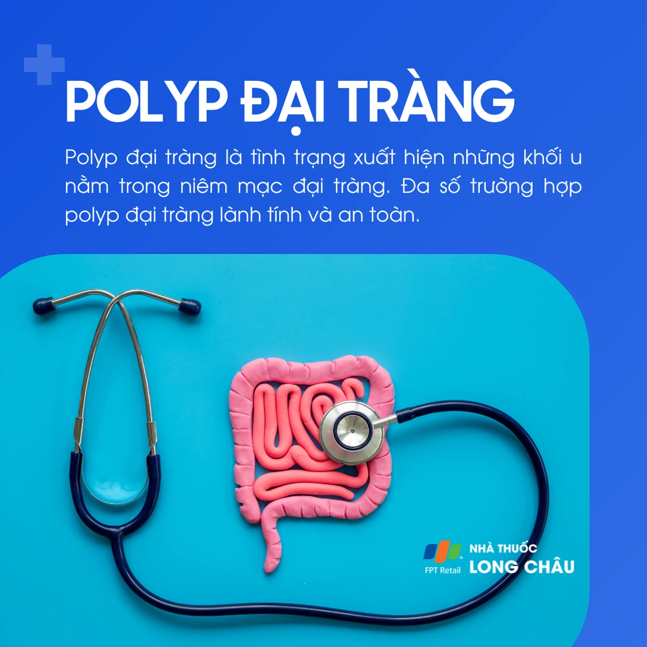 Polyp đại tràng 1