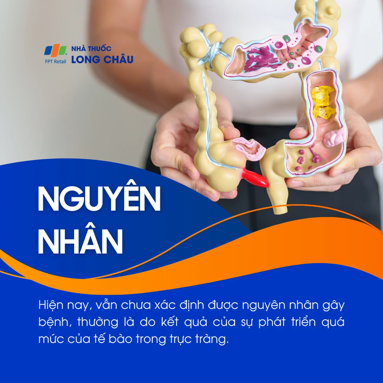 Polyp trực tràng 3