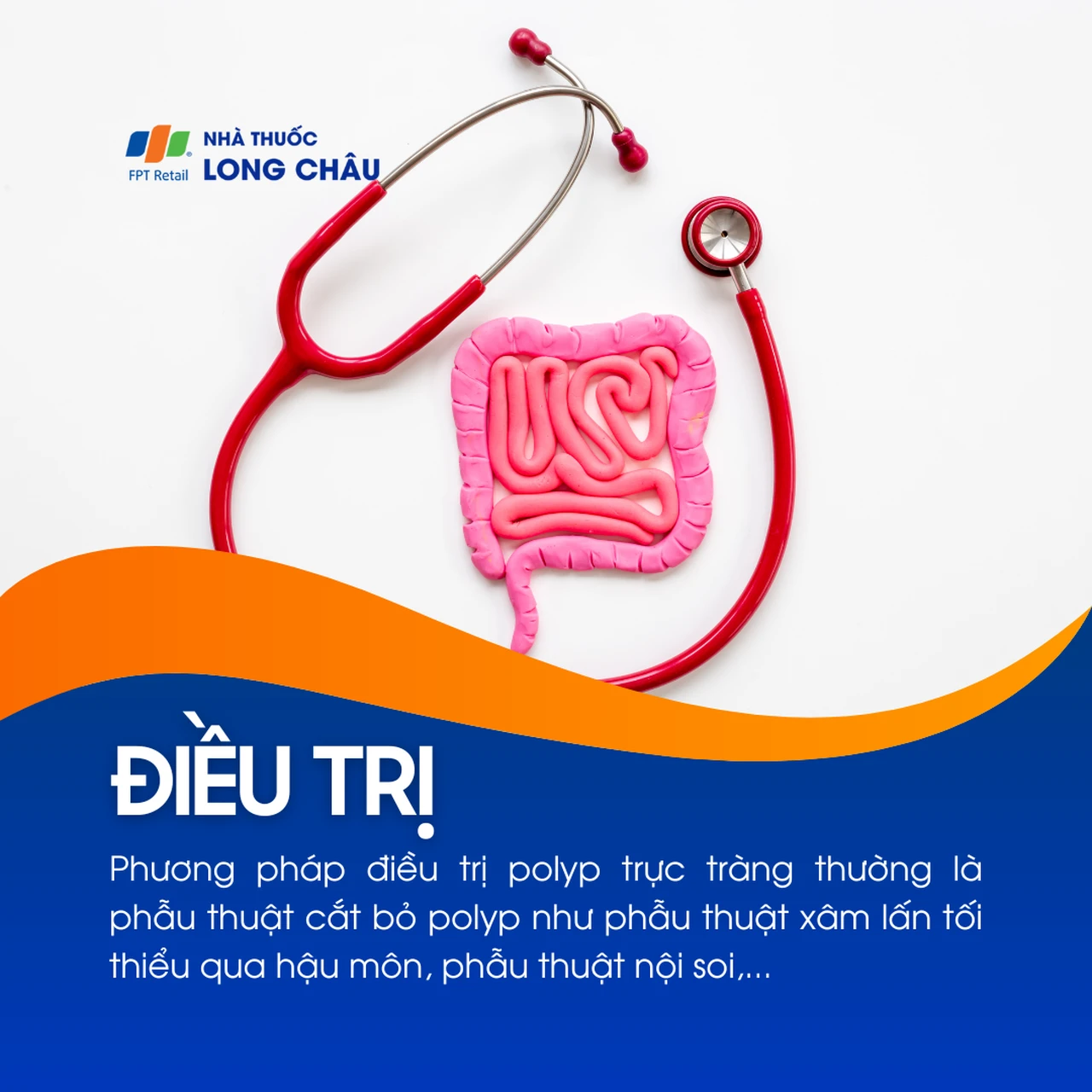 Polyp trực tràng 6