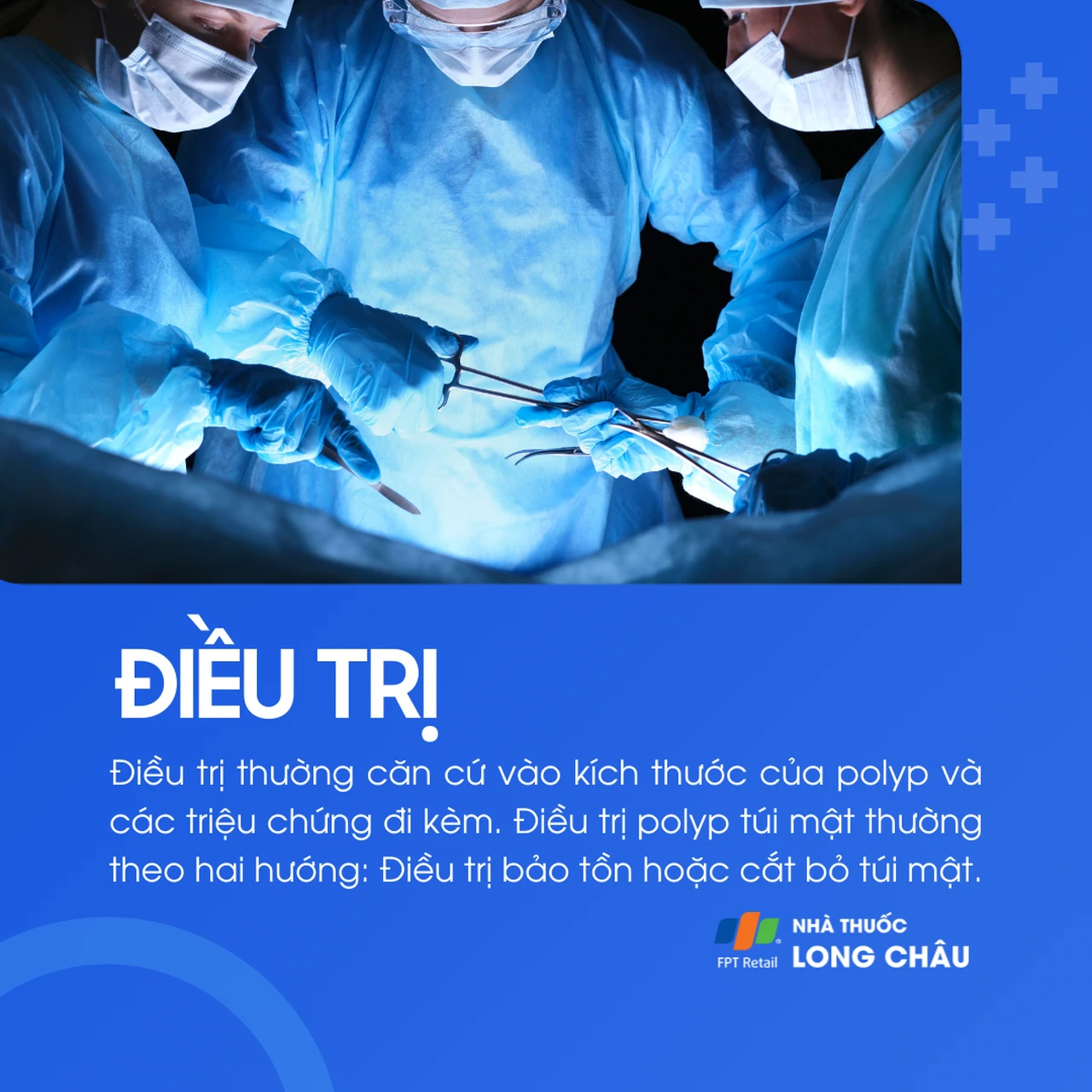 Polyp túi mật 6