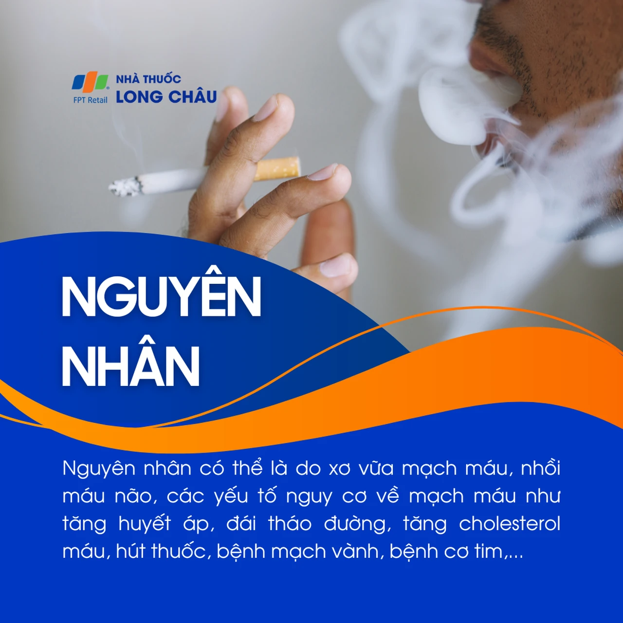 Sa sút trí tuệ do mạch máu não 3