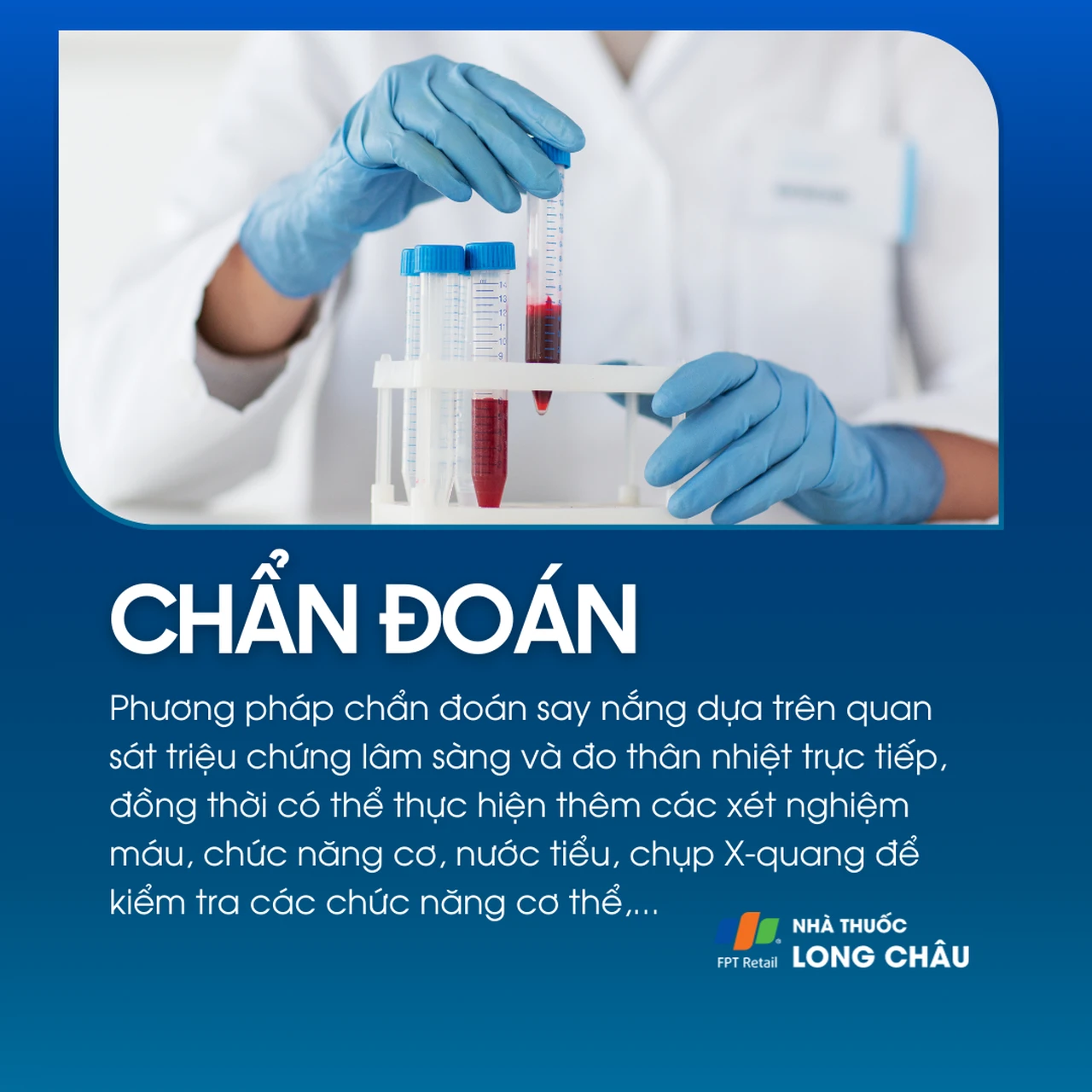 Say nắng là gì? Tình trạng cơ thể bị sốc nhiệt 5