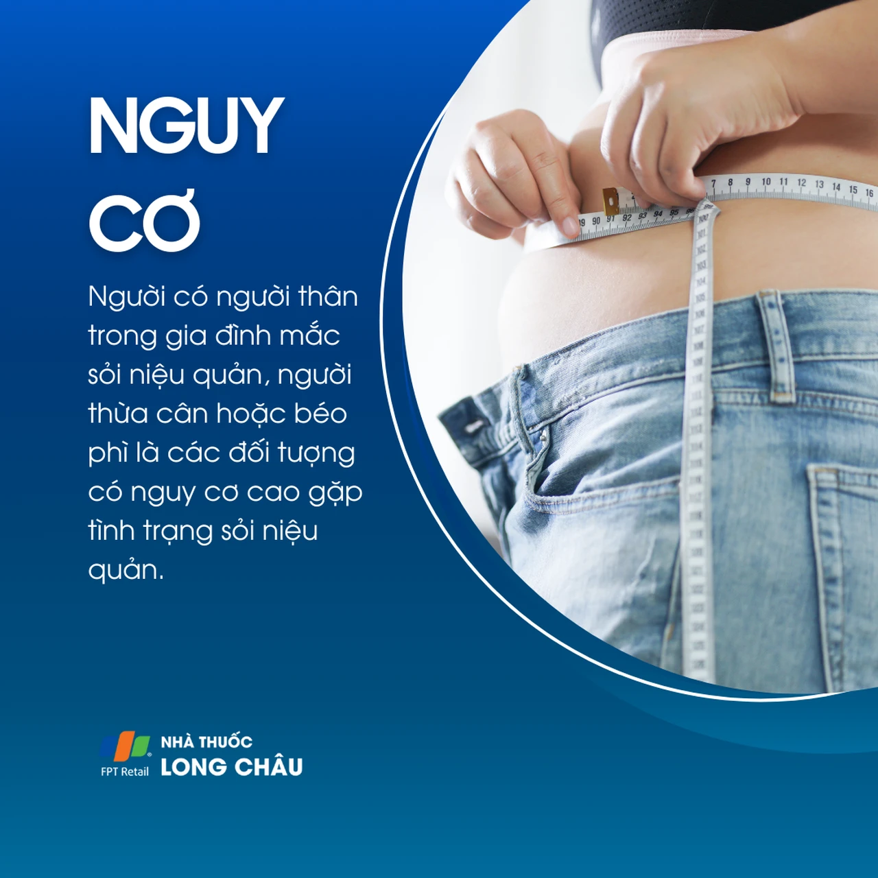 Sỏi niệu quản 4