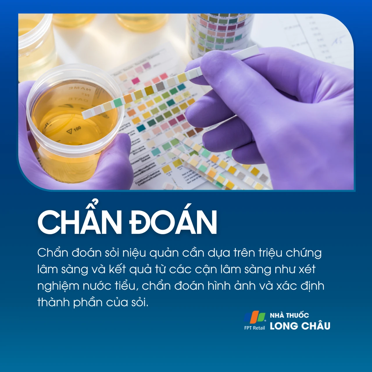 Sỏi niệu quản 5