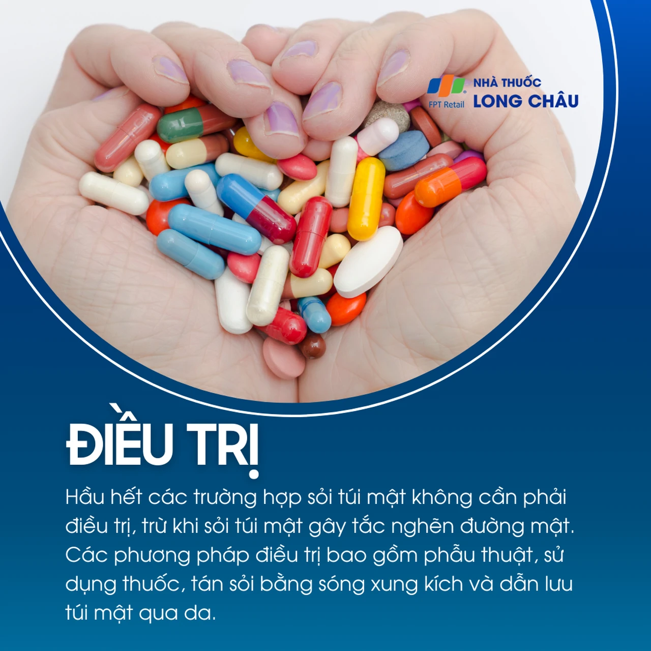 Sỏi túi mật 6