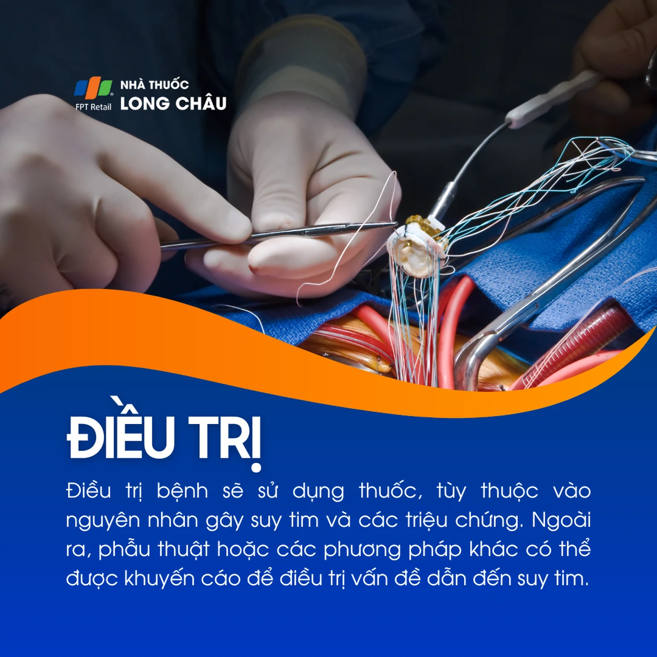 Suy tim giai đoạn cuối 6