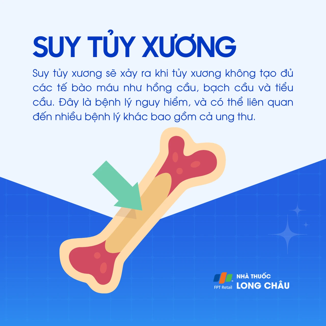 Suy tủy xương 1