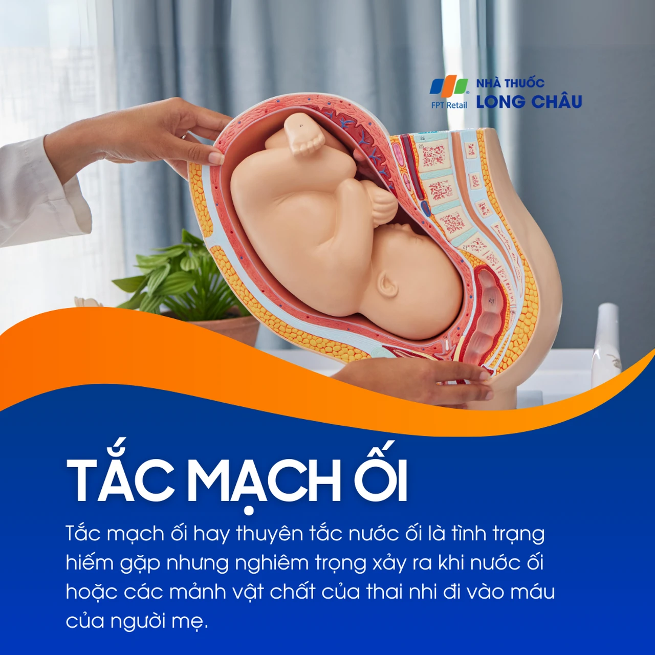 Tắc mạch ối 1