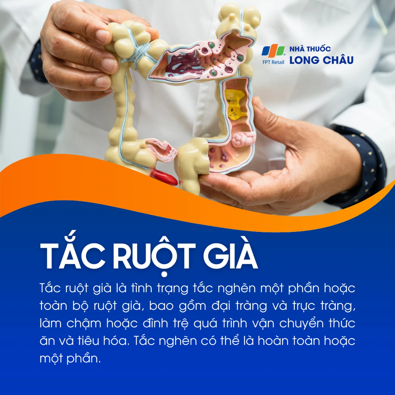 Tắc ruột già 1