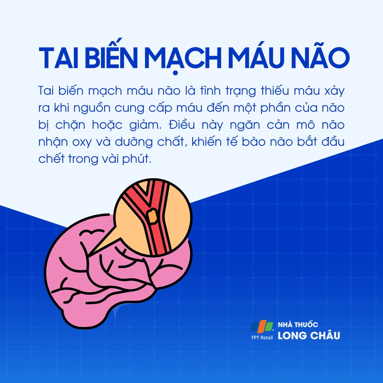 Tai biến mạch máu não 1
