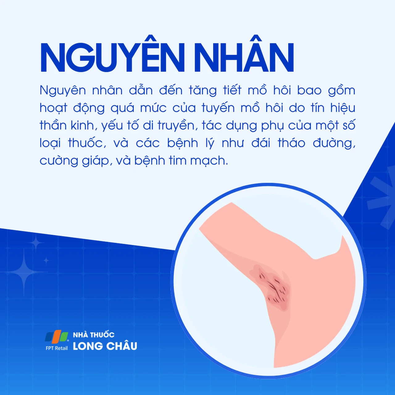 Tăng tiết mô hôi 3