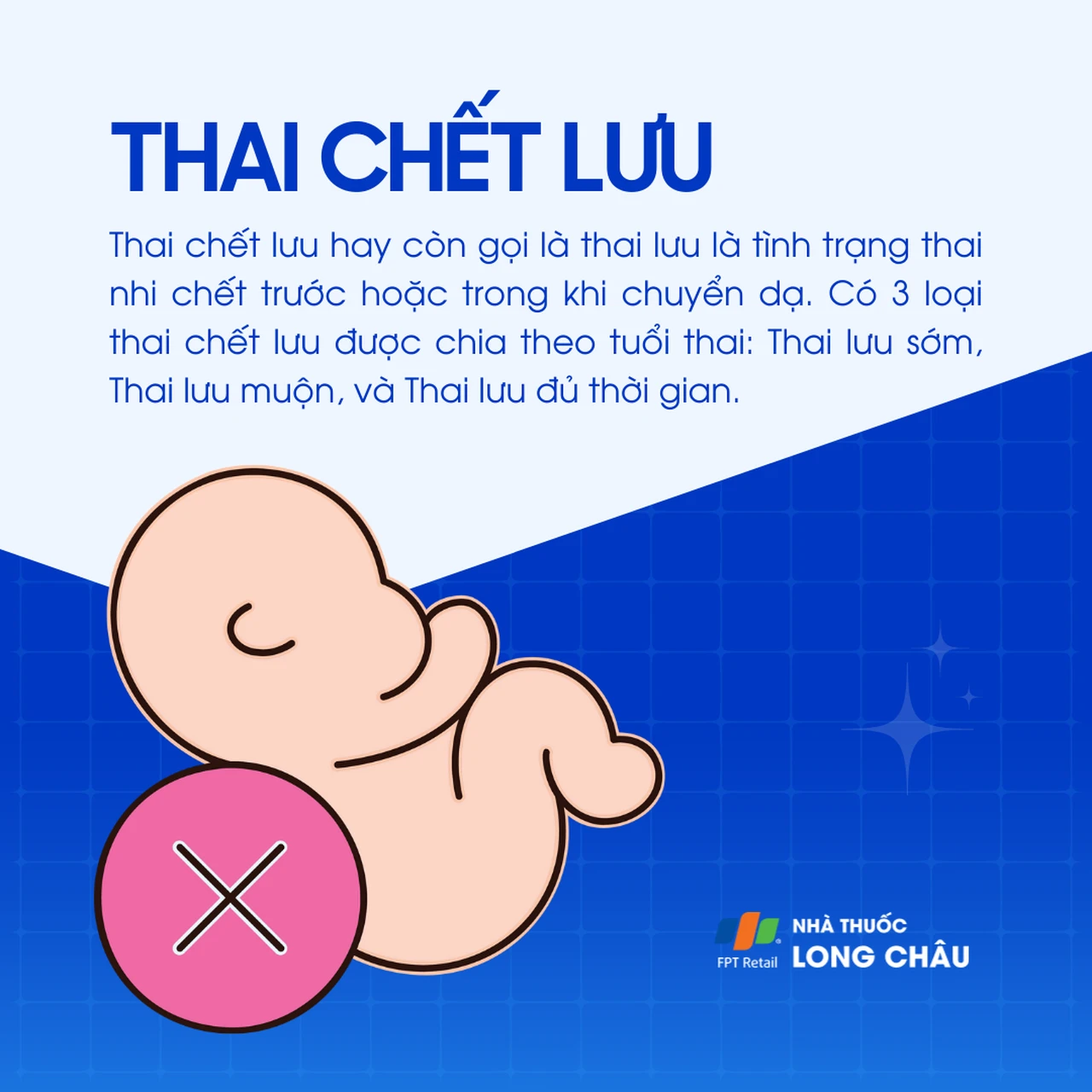 Thai chết lưu 1