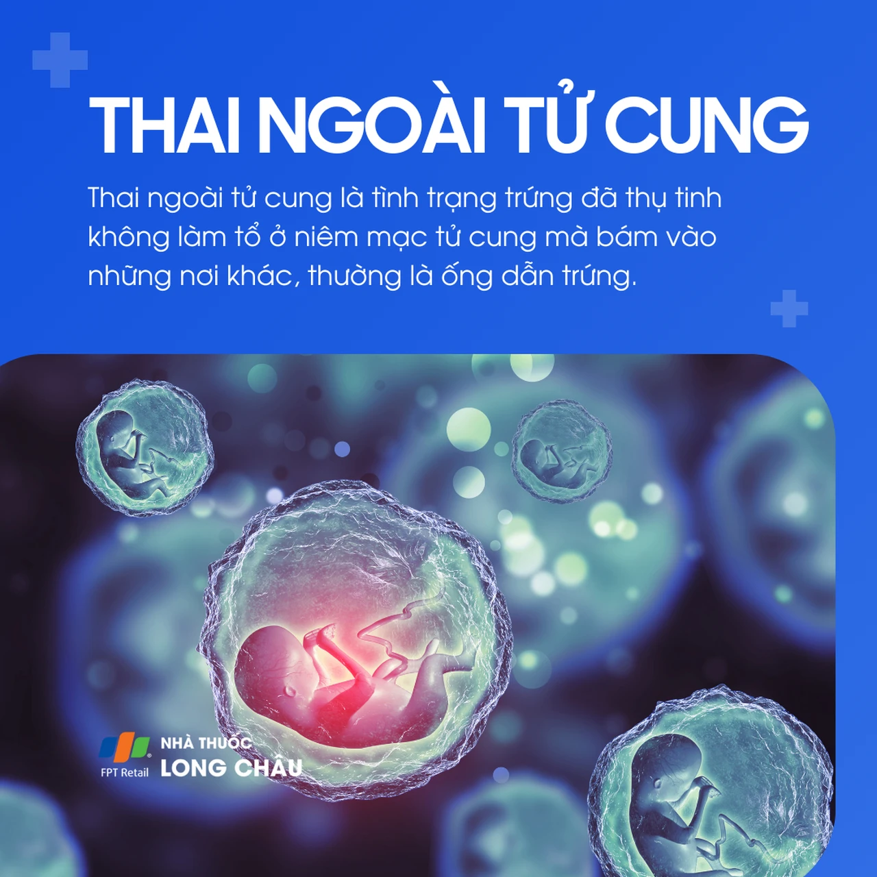 Thai ngoài tử cung 1