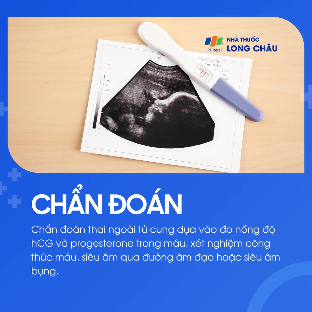 Thai ngoài tử cung 5