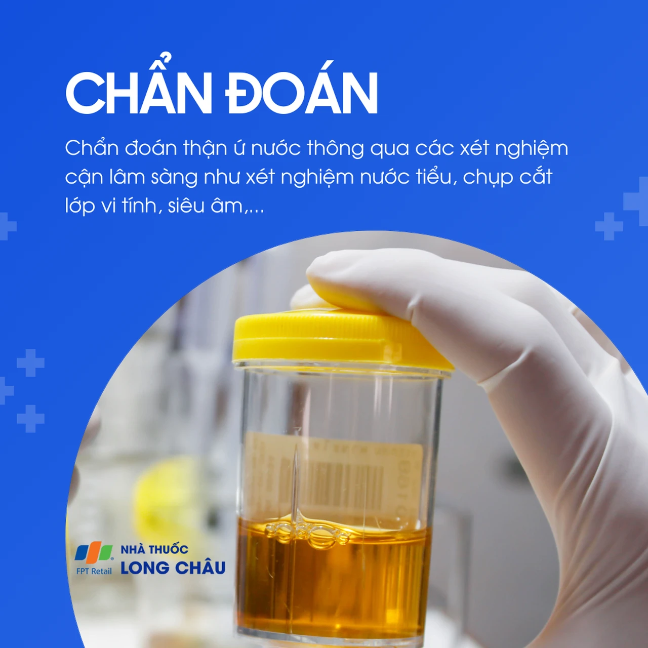 Thận ứ nước 5