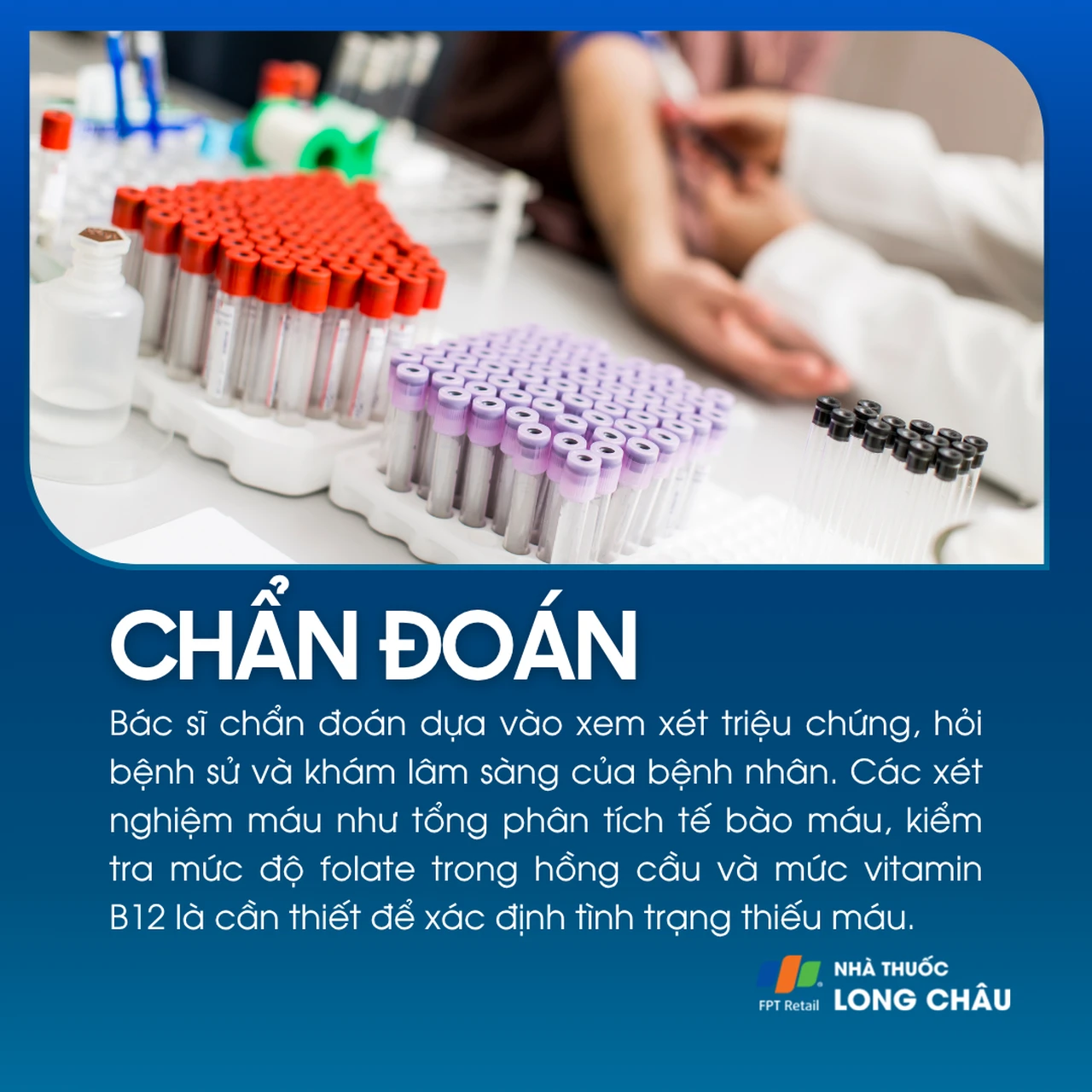 Thiếu máu do thiếu folate 5