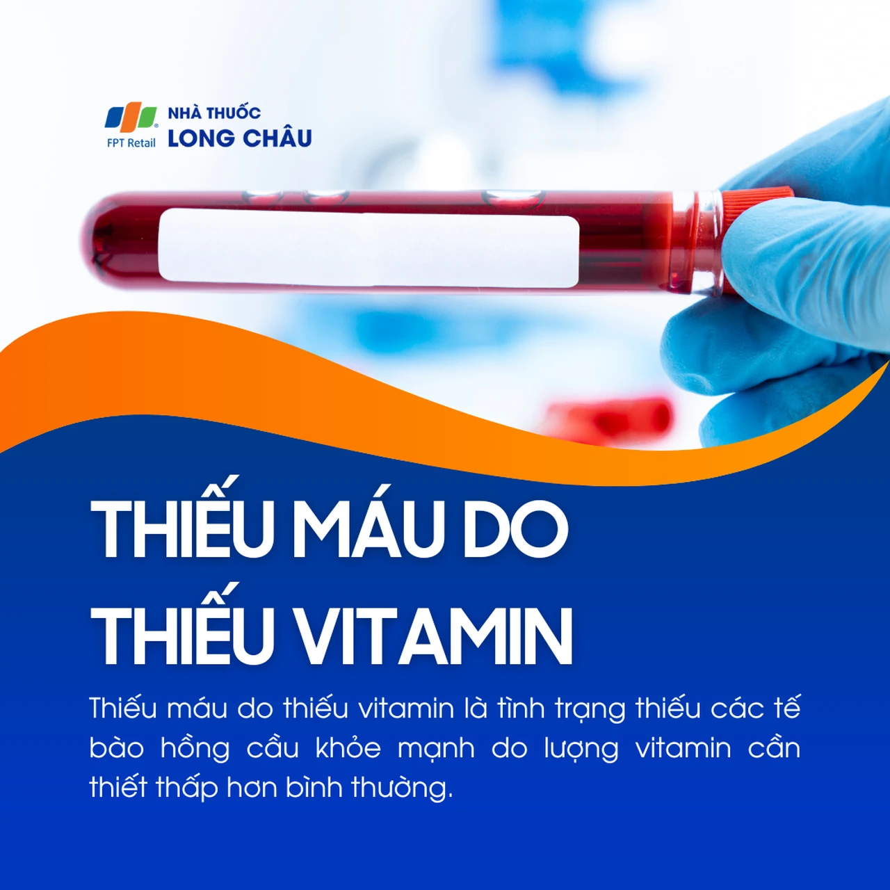 Thiếu máu thiếu vitamin 1