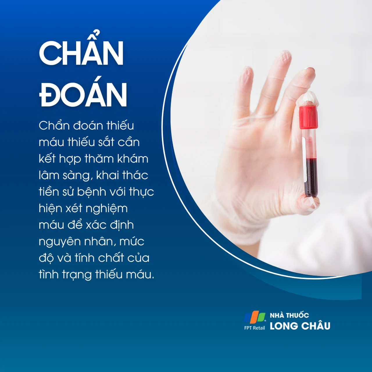 Thiếu máu thiếu sắt 6