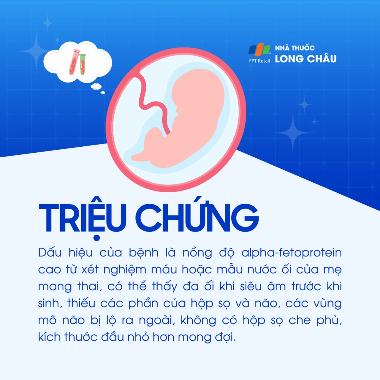 Thiếu một phần não 2