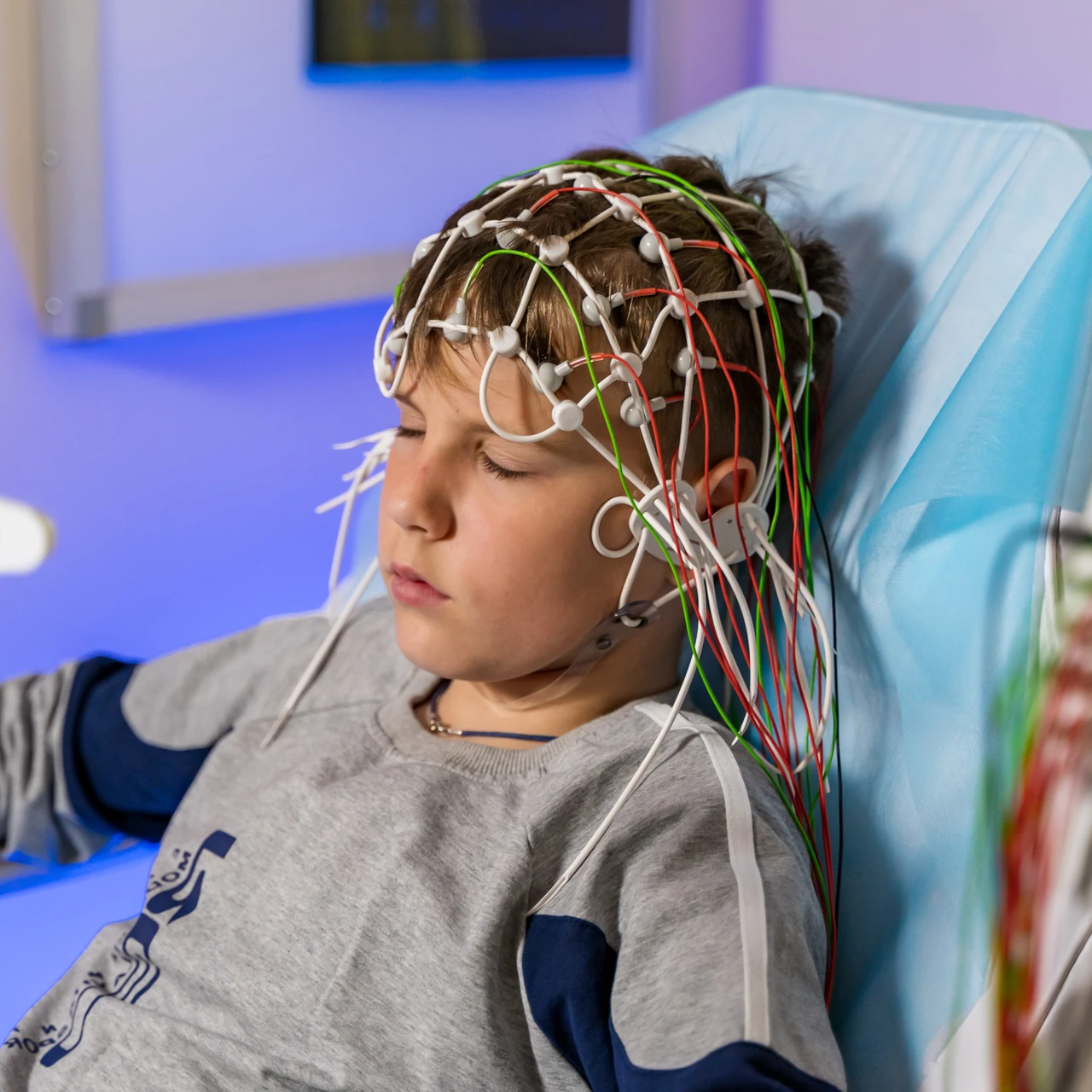 Thiểu sản tiểu não 2