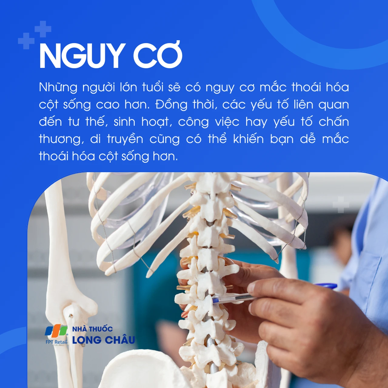 Tai biến mạch máu não 4