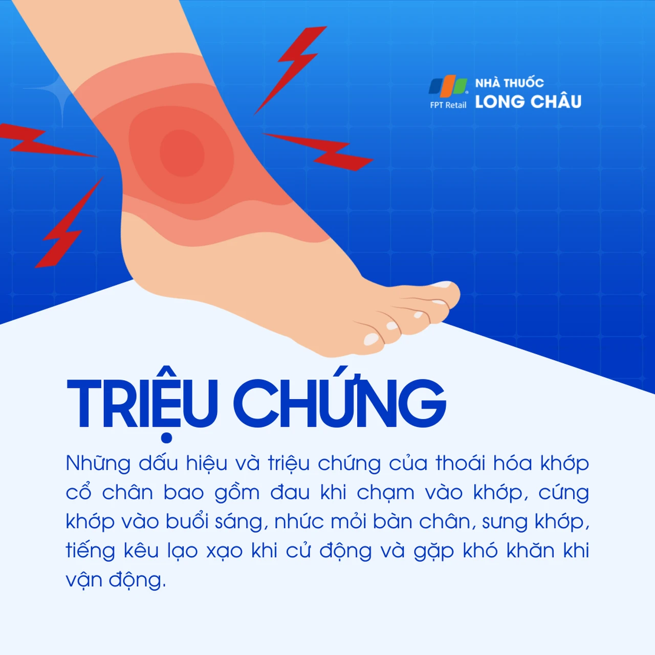 Thoái hóa khớp cổ chân 2