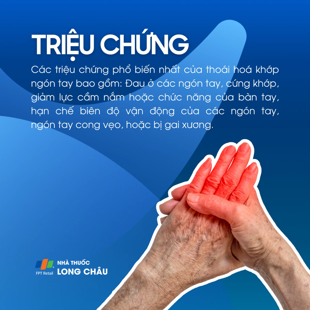 Thoái hóa khớp ngón tay 2