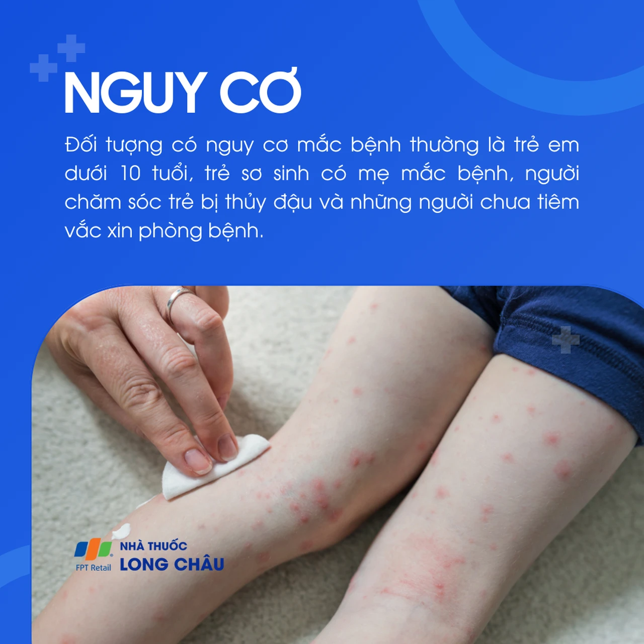 Trẻ em dưới 10 tuổi là đối tượng dễ mắc bệnh thủy đậu nhất