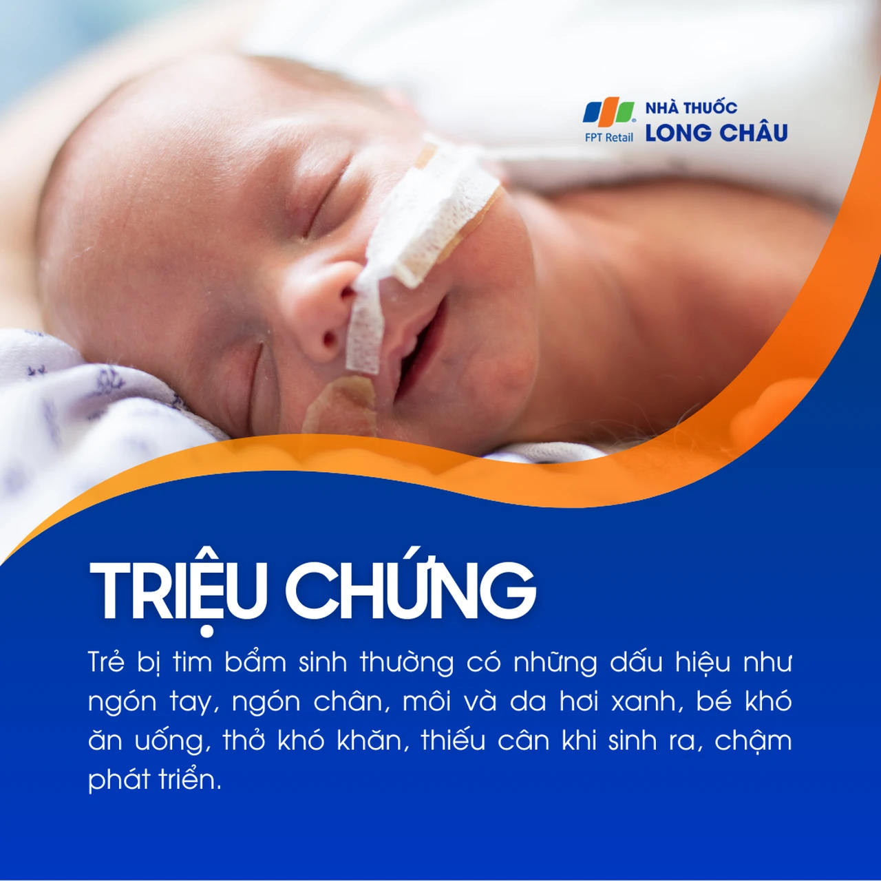 Bệnh tim bẩm sinh 2