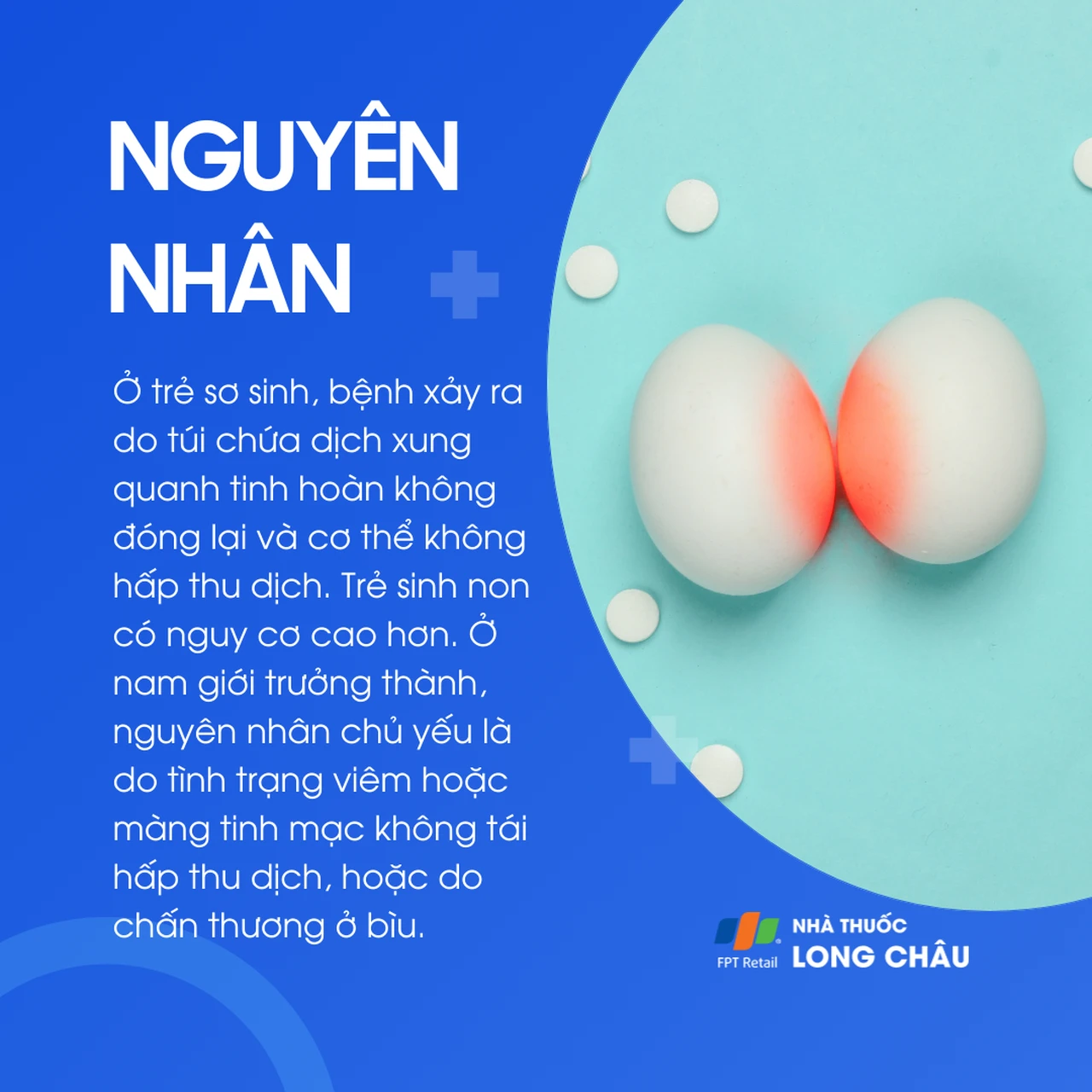 Tràn dịch tinh mạc 3