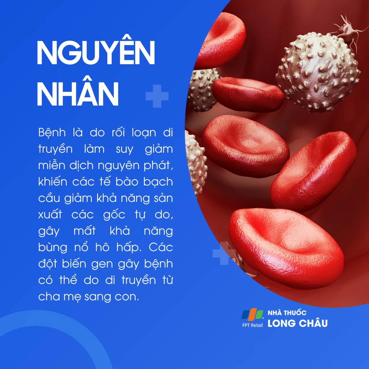 U hạt mạn tính 3