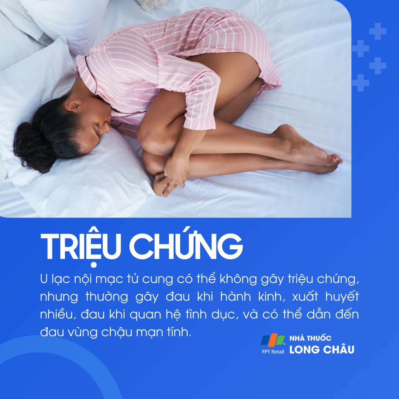 U lạc nội mạc tử cung 2