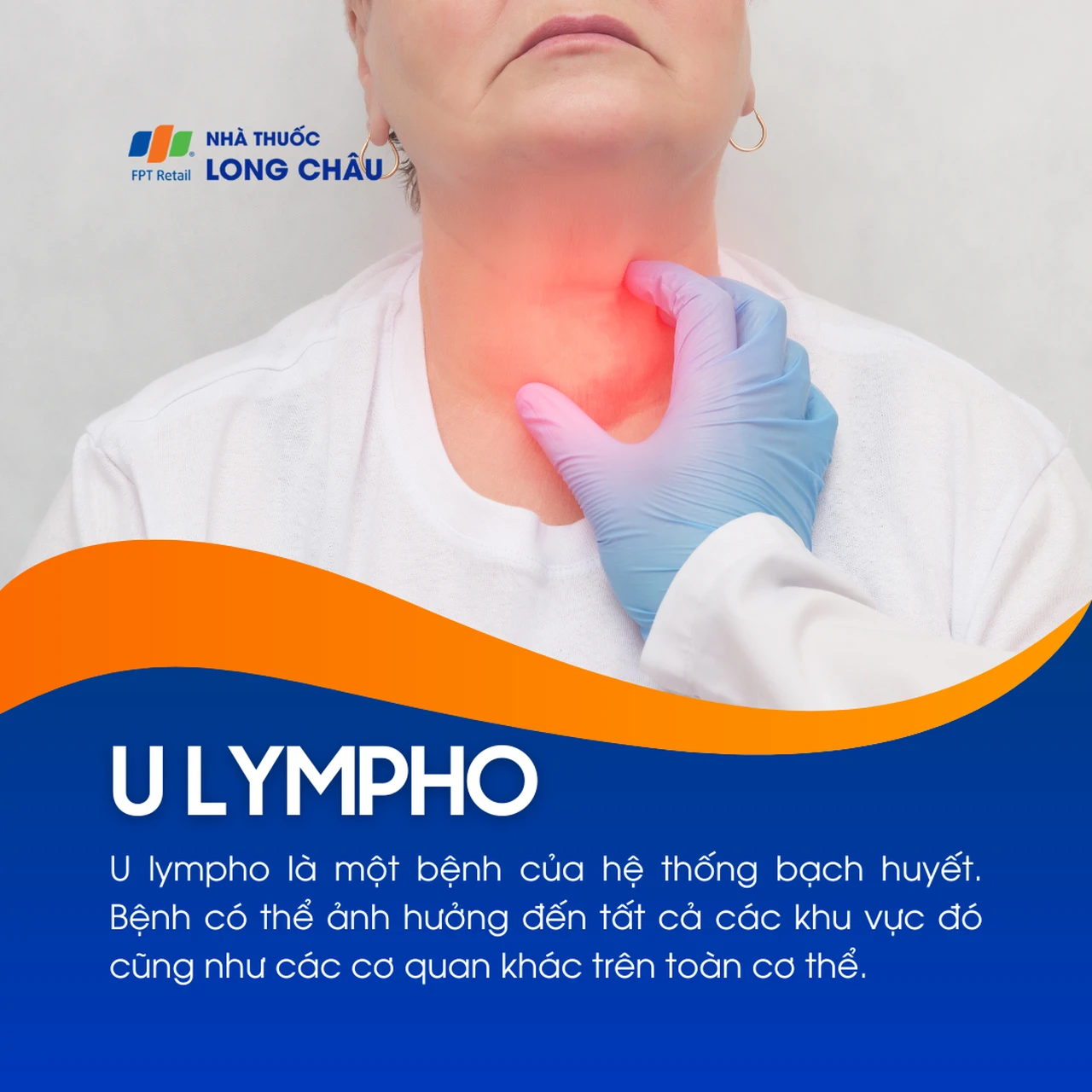 U lympho 1