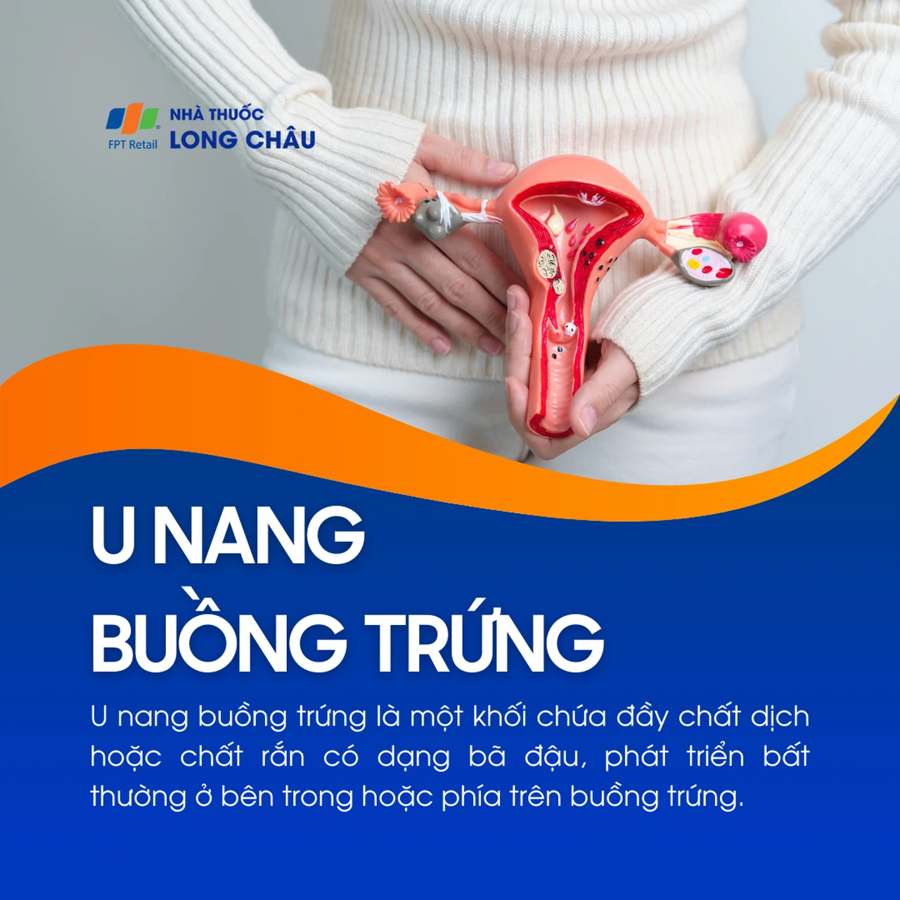 U nang buồng trứng 1
