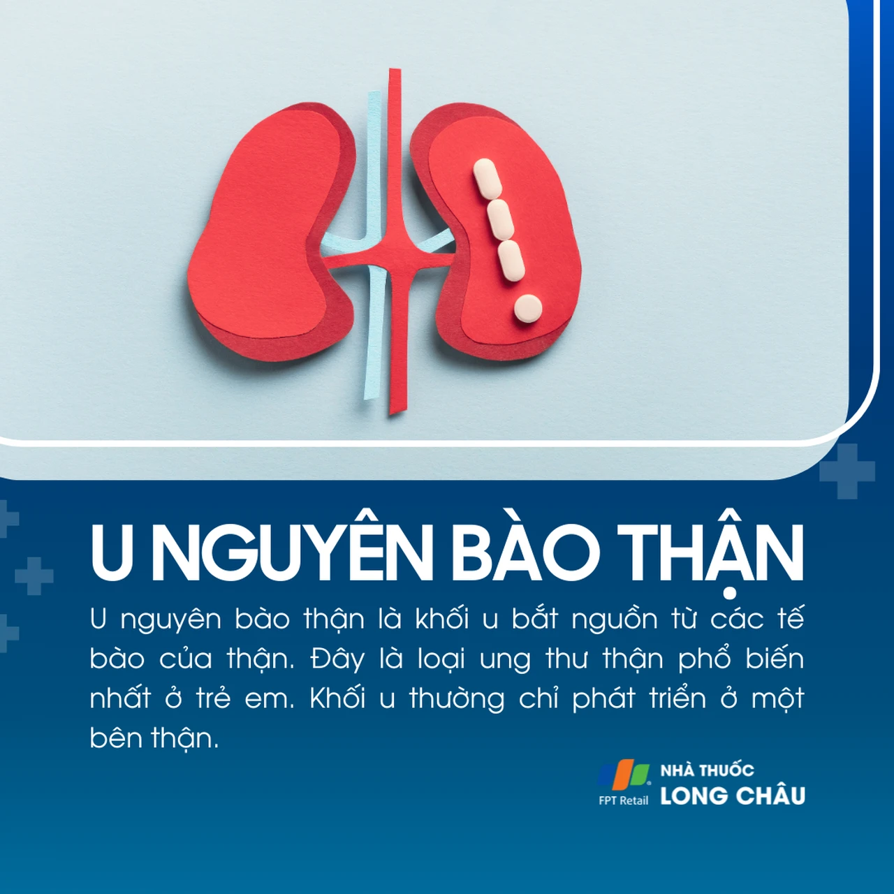 U nguyên bào thận 1