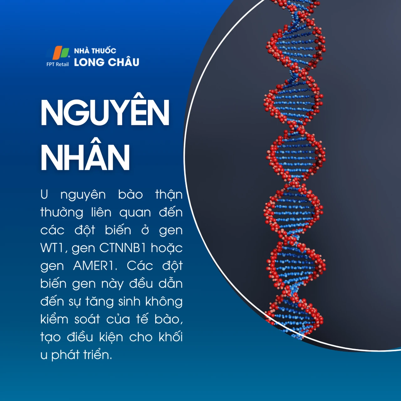 U nguyên bào thận 3