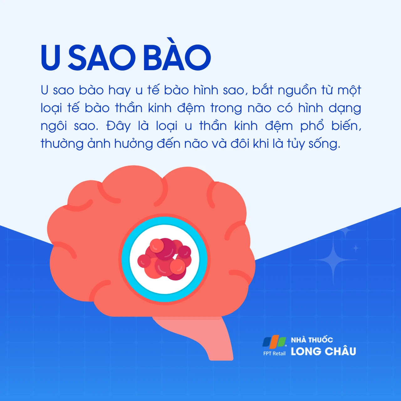 U sao bào 1