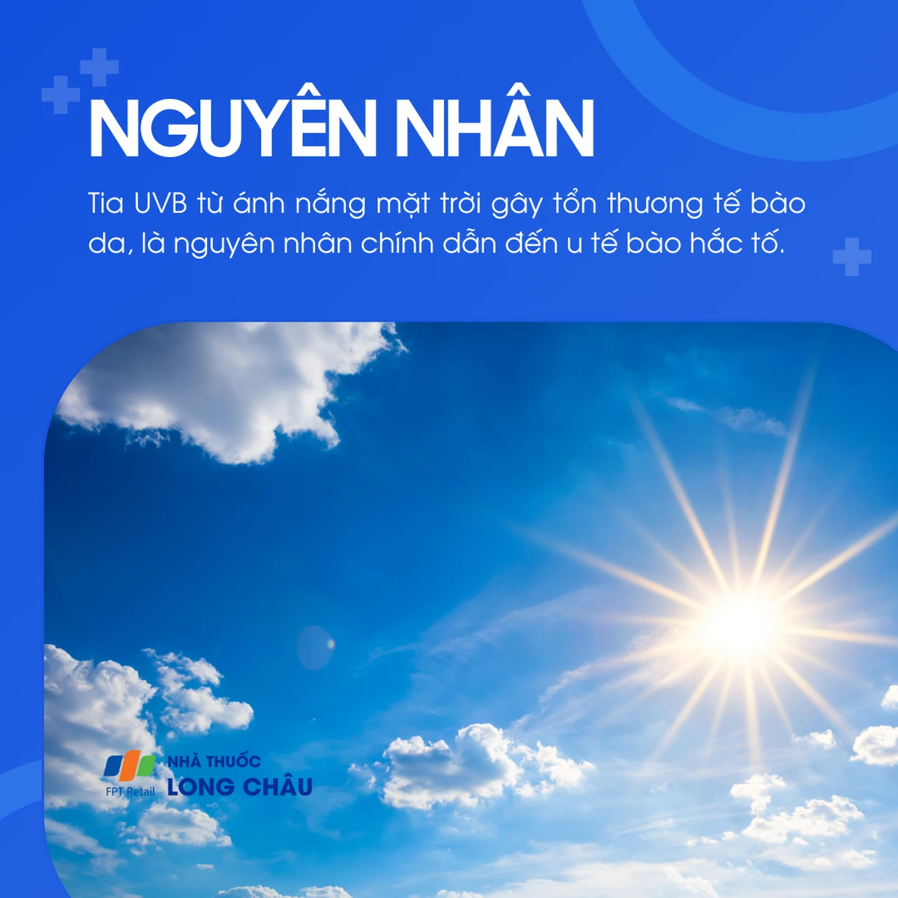 U tế bào hắc tố 3