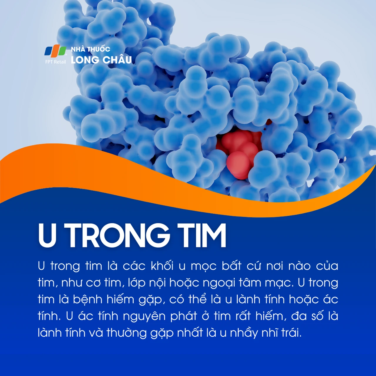 U trong tim 1
