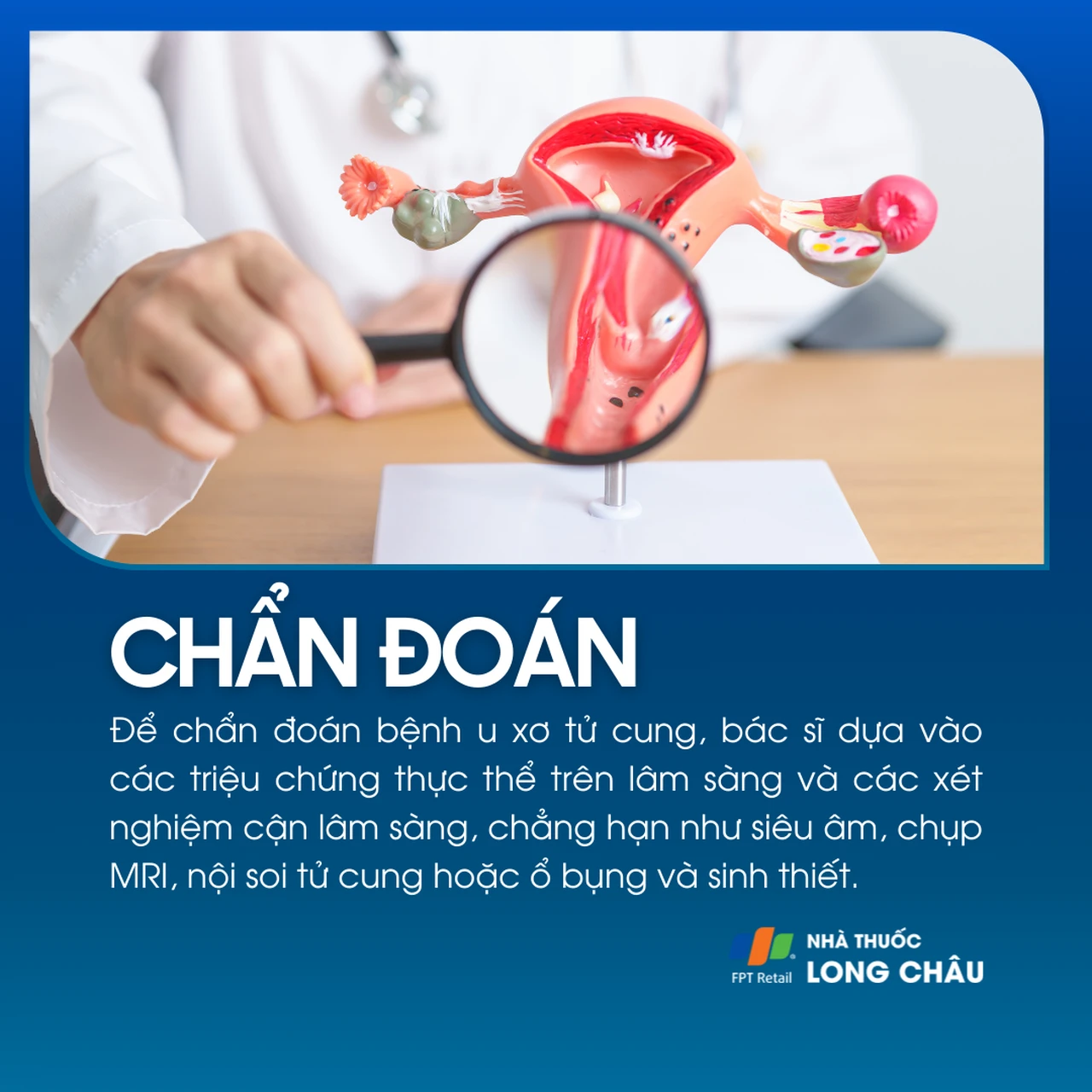 U xơ tử cung 5